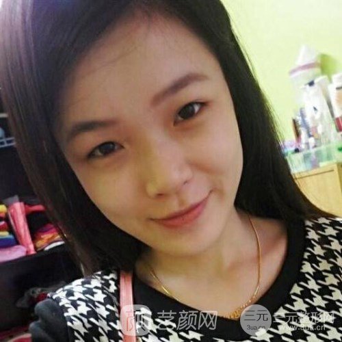 上海華美楊亞益主任做的芭比雙眼皮，果很好哦~